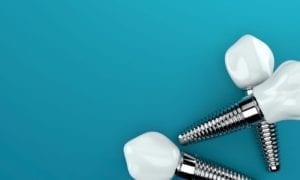 affordable dental implants in peachtree city, georgia